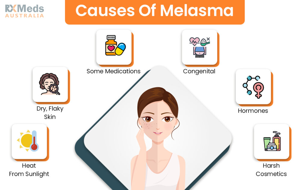 Melasma